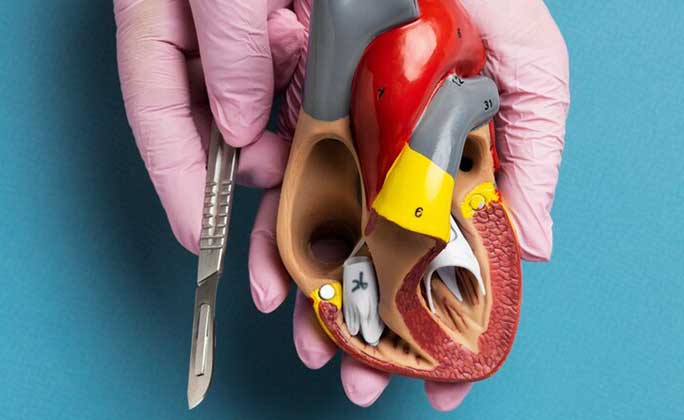 Cardiothoracic Surgery